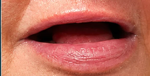 Implant and reconstructive surgery — before