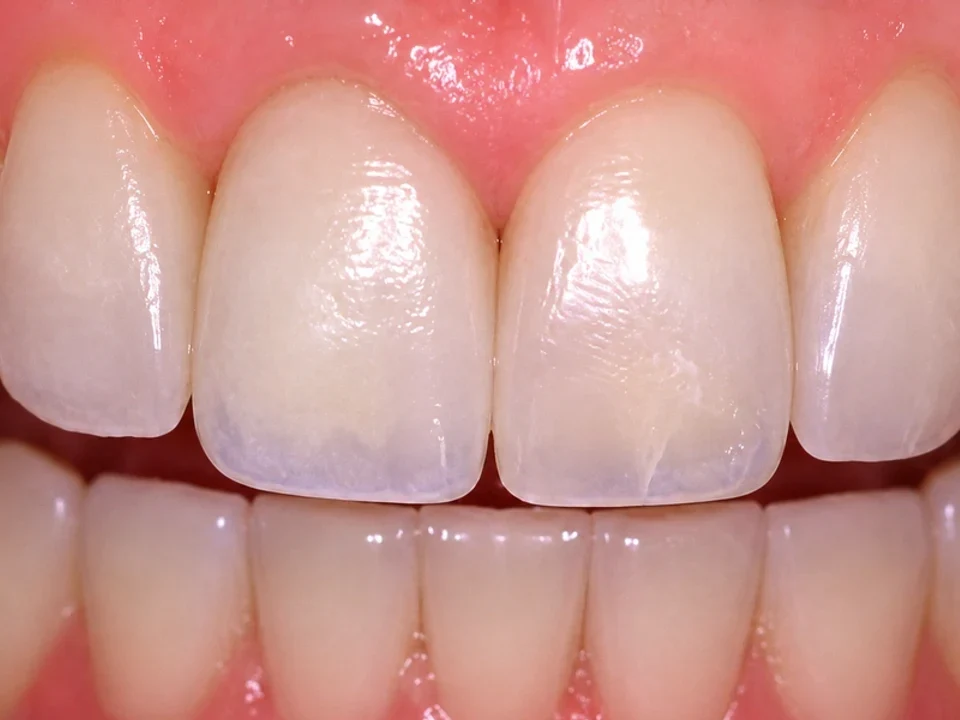 Miracle smiles through implants at The QDC — after