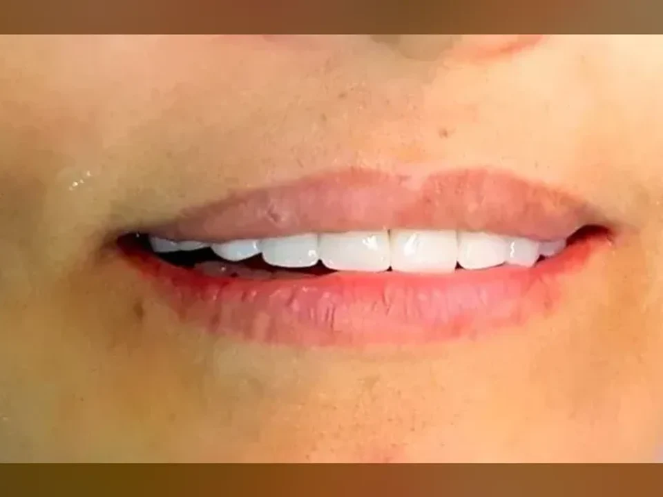 Transforming smiles, enhancing lives — after