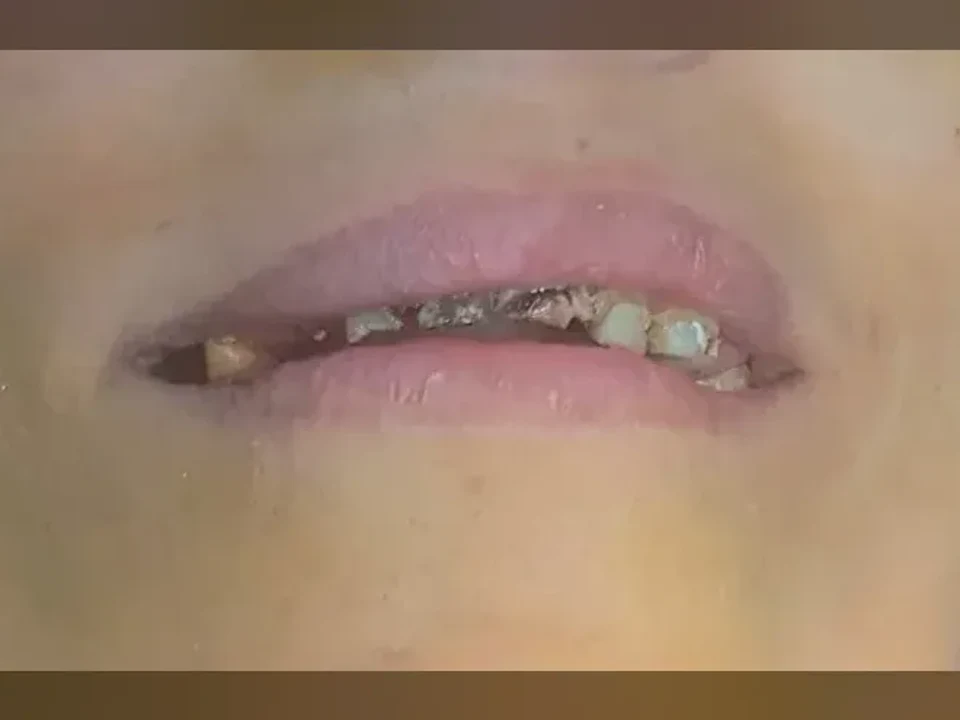 Transforming smiles, enhancing lives — before