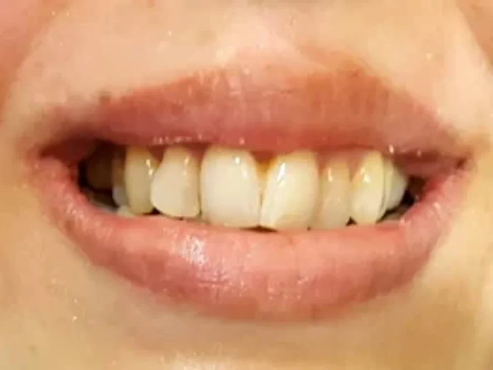 Natural smile ready for aesthetic refinement — before