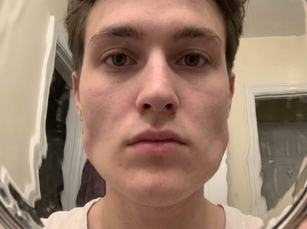 Distorted Facial Contour